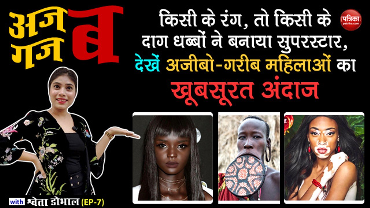 किसी के रंग, तो किसी के दाग धब्बों ने बनाया सुपरस्टार, देखें अजीबो-गरीब महिलाओं का खूबसूरत अंदाज: अजब गजब with Shweta Dhobhal (EP-7)