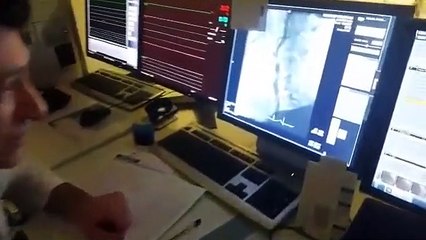 BEYİN DAMARLARINDA DARLIK OLAN 88 YAŞINDA Kİ HASTAMIZA YAPILAN MÜDAHALE