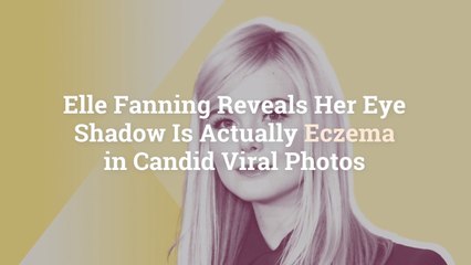Elle Fanning Reveals Her Eye Shadow Is Actually Eczema in Candid Viral Photos