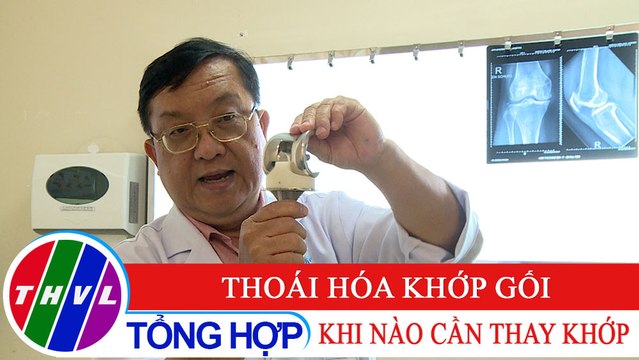 Sức khỏe của bạn: Thoái hóa khớp gối - Khi nào cần thay khớp