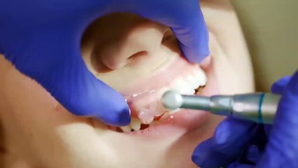 Best Teeth Whitening Services are Given by Trained Dentist Northwest Calgary