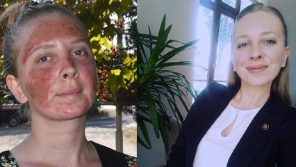 Cilt bakımı yaptırdı, şimdi aynaya bakamıyor