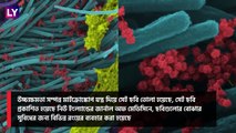 COVID-19| Infected Respiratory Cells: ফুসফুসের রন্ধ্রে-রন্ধ্রে করোনা, গবেষকদের ছবিতে আঁতকে উঠবেন