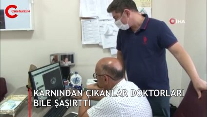 Karnından çıkanlar doktorları bile şaşırttı