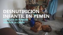 Los programas para combatir la desnutrición infantil en Yemen sufren recortes en sus fondos