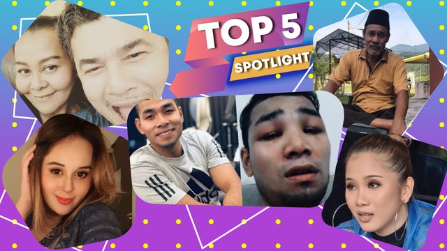 Top 5 Sportlight: Muka Syafiq Farhain bengkak kerana tanam rambut, perkahwinan Ratu Balqis musnah