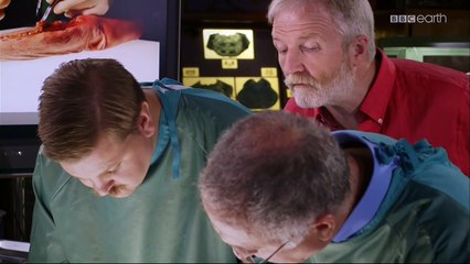 Jak działają nasze kończyny - dłonie