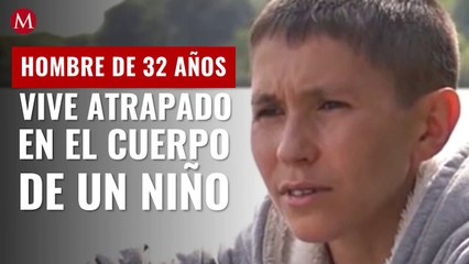 Hombre de 32 años vive atrapado en el cuerpo de un niño: no estoy envejeciendo