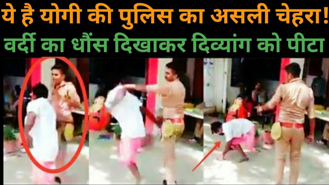 Yogi की रक्षक पुलिस बनी भक्षक! वर्दी का धौंस दिखाकर दिव्यांग को बेरहमी से पीटा