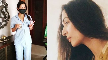 Malaika Arora की Corona के बाद हो गई ऐसी हालत, मुरझा गया चेहरा,सूज गई आंखे । Boldsky