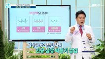 [HEALTHY] Heart warning arrhythmia! What's the cure for sudden death, 기분 좋은 날 20200929