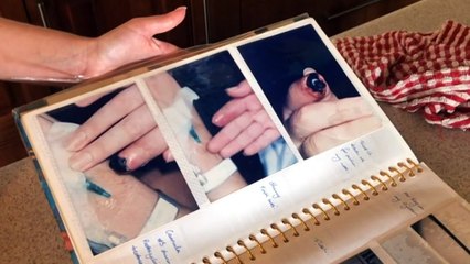 Experts want to know why frostbite prevalent in Cairns