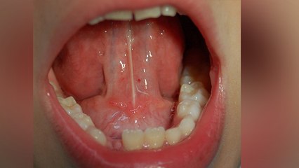 जीभ से करें सिर्फ 1 मिनट ये एक्सरसाइज, कई बीमारियों से मिलेगा निजात | Tounge Exercise | Boldsky