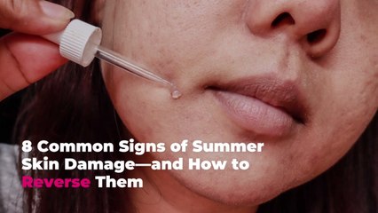 8 Common Signs of Summer Skin Damage—and How to Reverse Them