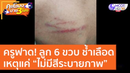 ครูฟาด! ลูก 6 ขวบ ช้ำเลือด เหตุแค่ “ไม่มีสีระบายภาพ” [24 ก.ย.63] คุยโขมงบ่าย 3 โมง | 9 MCOT HD