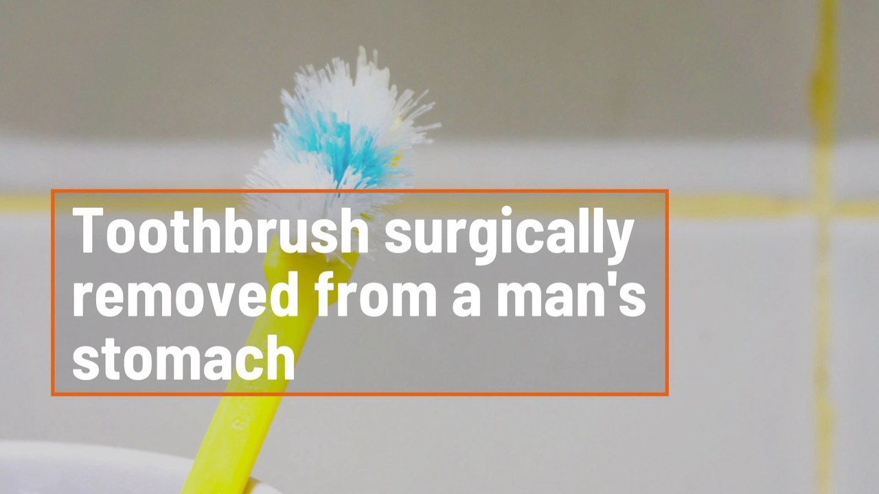 This Dude Ate A Toothbrush
