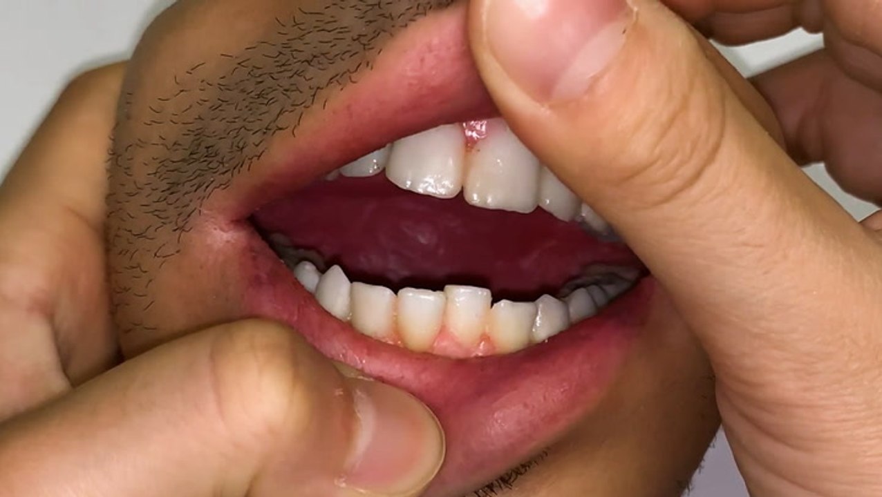 Designers create these hyperrealistic human-flesh accessories that move