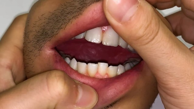 Designers create these hyperrealistic human-flesh accessories that move