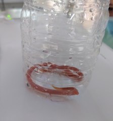 Au CHU de Nantes : une femme enceinte vomit un ver de 20 cm