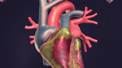 الأمراض القلبية والوعائية تأتي في صدارة أسباب الوفيات