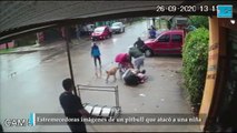 Estremecedoras imágenes de un pitbull que atacó a una niña