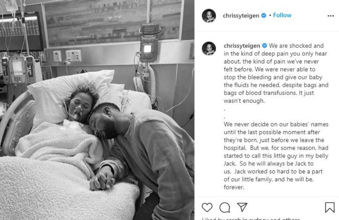 Chrissy Teigen has suffered a miscarriage