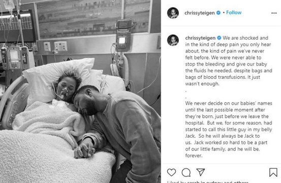 Chrissy Teigen erleidet Fehlgeburt