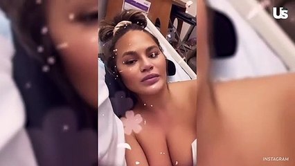 Chrissy Teigen Suffers Pregnancy Loss Following Complications