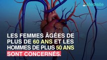 Maladies cardio-vasculaires : les personnes à risque