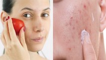 Skin के लिए बेहद ही फायदेमंद होता है टमाटर, जानें लगाने का सही तरीका | Tomatoes For Skin | Boldsky