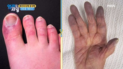 ※충격※ 코로나 후유증…! 확진자 10명 중 9명…?