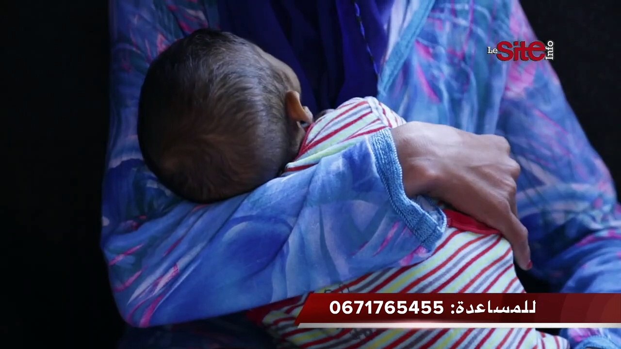 حالة تدمي القلوب.. رضيع بين الحياة و الموت: ولدي محتاج عملية ب72مليون باش اعيش