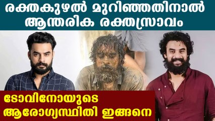 Tovino thomas's health condition, recent update | Oneindia Malayalam