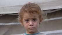 تفشي أمراض جلدية معدية في مخيمات اللجوء شمال سوريا