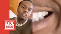 Spit So Hard: Gunna Accidentally Swallows A Tooth Diamond