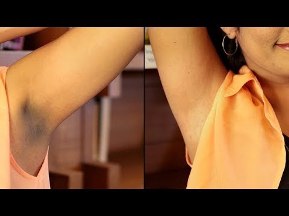 அக்குள் கருமையை போக்குவது எப்படி? - Beauty Tips in Tamil