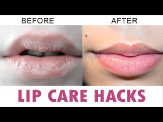 How to get rid of Dry lips in Winter Season | SaySwag