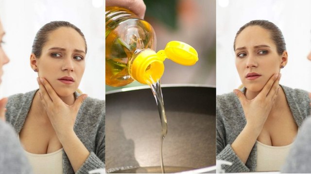 सरसों के तेल से बना ये Face Pack निखारेगा खूबसूरती और दूर होंगे Dark Spots | Mustard Oil Face Pack