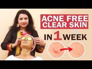 Remove Pimple&Acne in 1week | Easy Face-pack | Overnight | Pimple