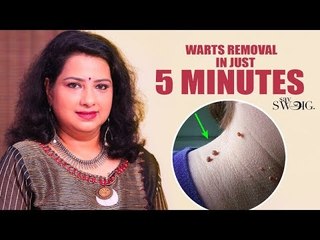 வலியில்லாமல் நிரந்தரமாக மருவை நீக்க எளிய வழி | Vasunthara Series