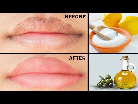 Simple Home Remedies for Dry Cracked LIPS! | Tips for chapped lips | #15dayschallenge Day 10