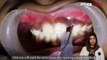 Comparison Of Use Of Scalpel And Dental Laser In Soft Tissue Surgery Orthodontic Exposure Of Tooth