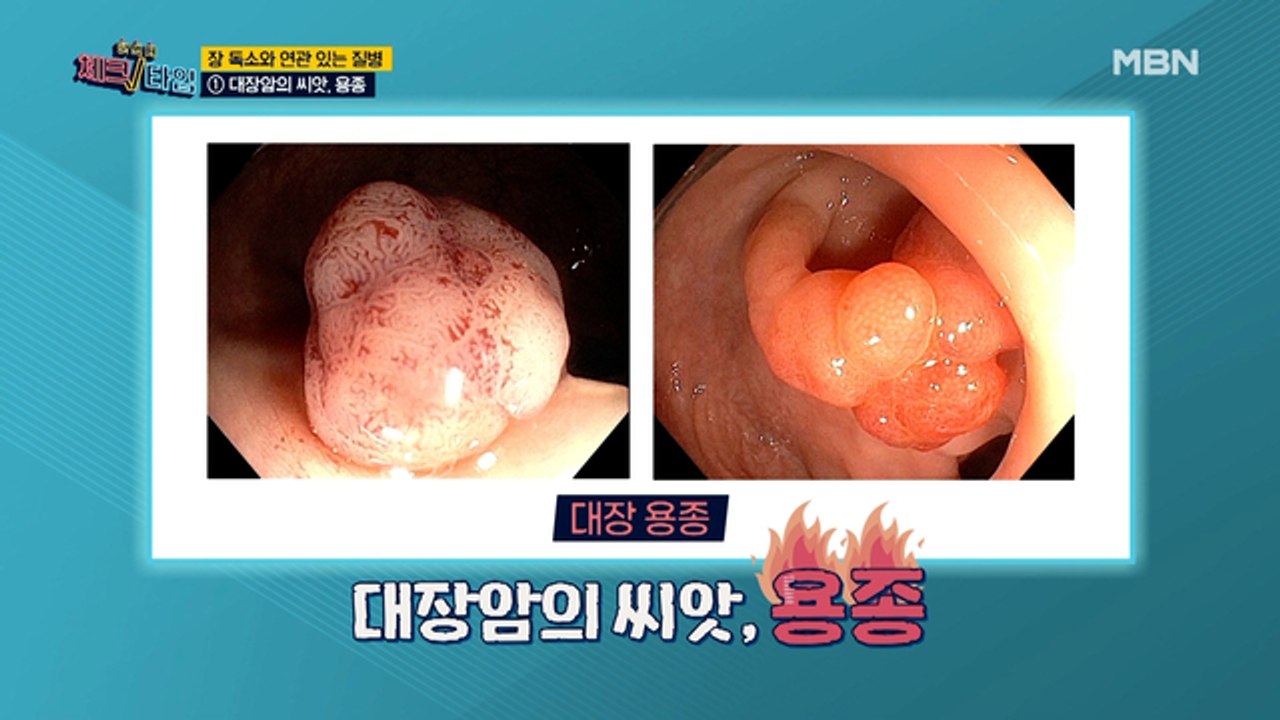 만병의 근원 장 독소가 부르는 질병은?
