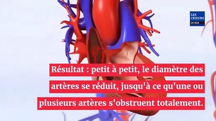 6 signaux que notre corps peut nous envoyer lorsque les artères sont bouchées