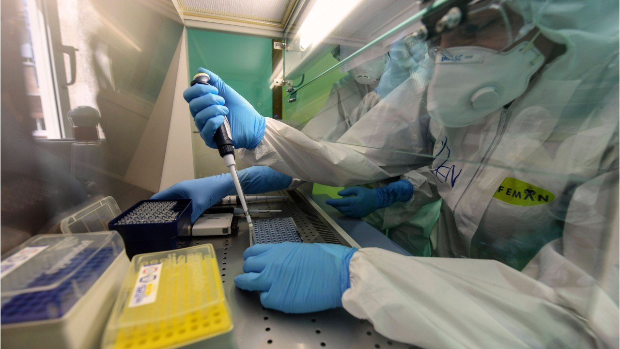 COVID-19 Patients Produce 'High-Quality' Antibodies