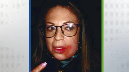 Mujer denuncia agresión por parte de concejal de Zipaquirá