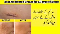Best Medicated Cream for all kind of scars And marks old and new | How to heal scars quickly