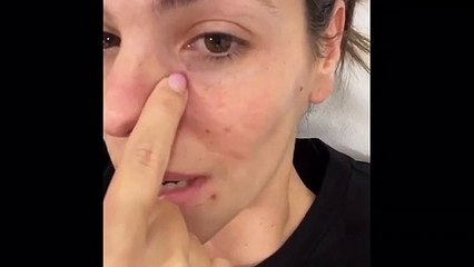 Laura Matamoros enseña su rostro al natural