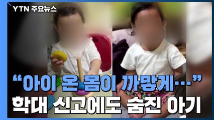 "온 몸이 까맣게..." 세 번의 학대 신고 뒤 숨진 아기 / YTN