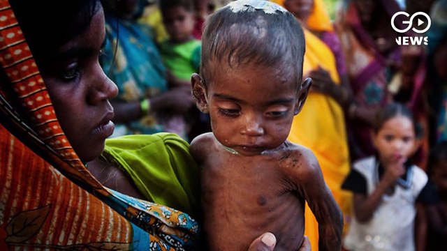 ग्लोबल हंगर इंडेक्स में पड़ोसी देशों से पिछड़ा भारत, नेपाल 73वें तो भारत 94वें स्थान पर